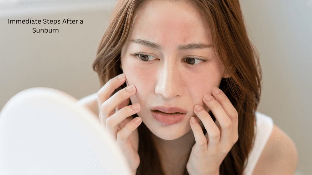 Immediate Steps After a Sunburn
