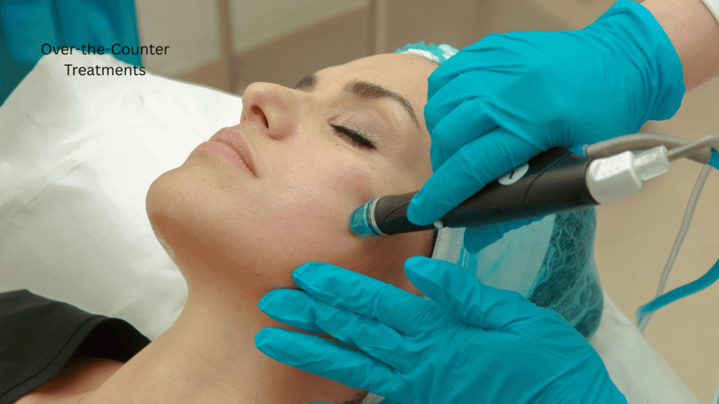 Over-the-Counter Treatments