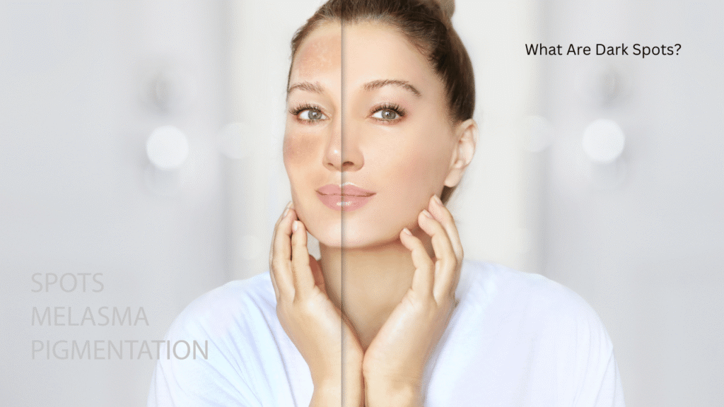 What Are Dark Spots?